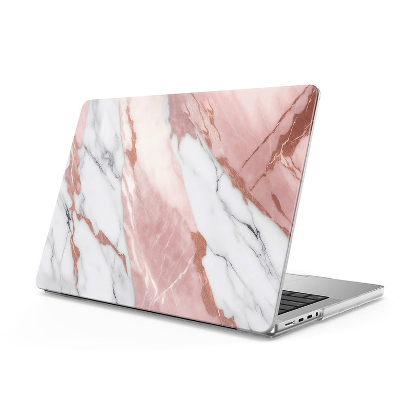 Pink White Jade - Macbook Case