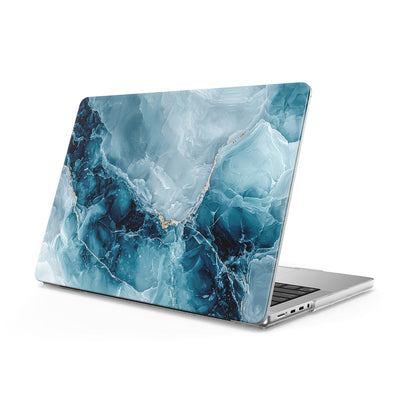 Ice Reef Blue - Macbook Case
