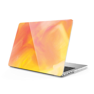 Attract - Macbook Case