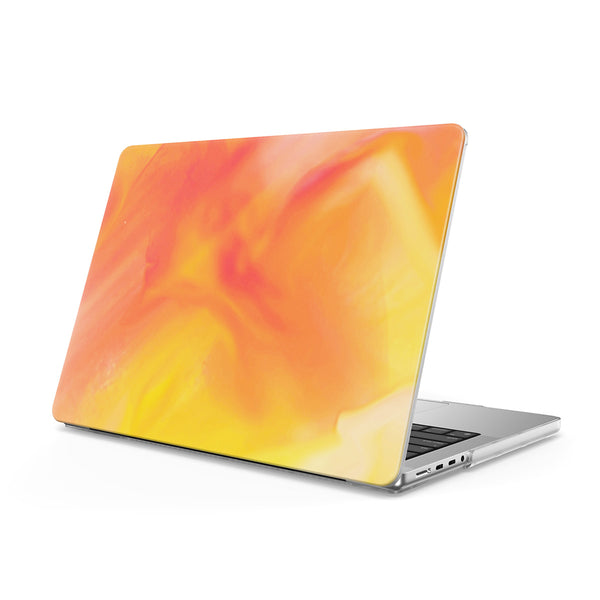 Attract - Macbook Case