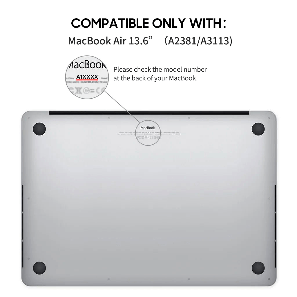 Queen - Macbook Case
