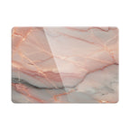 Elegant Rose Gold - Macbook Case