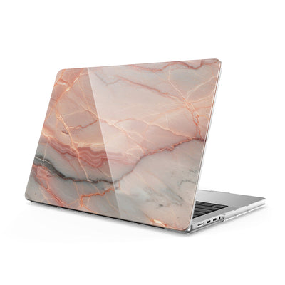 Elegant Rose Gold - Macbook Case
