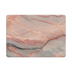 Elegant Rose Gold - Macbook Case