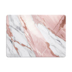 Pink White Jade - Macbook Case