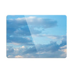 Peaceful Afternoon - Macbook Case