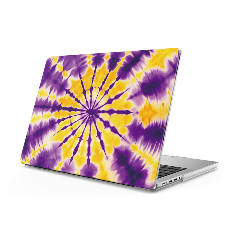 Amber Glow - Macbook Case