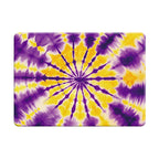 Amber Glow - Macbook Case