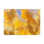 Golden Moment - Macbook Case