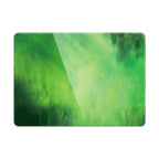 Forget - Macbook Case