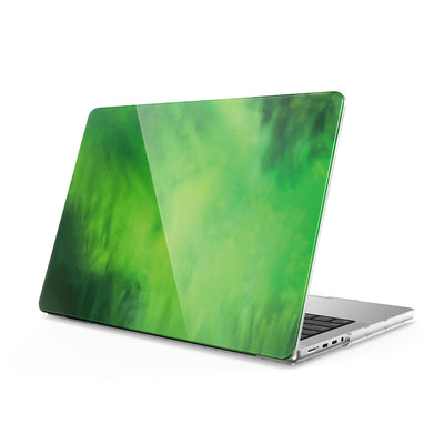 Forget - Macbook Case