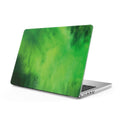 Forget - Macbook Case