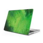 Forget - Macbook Case