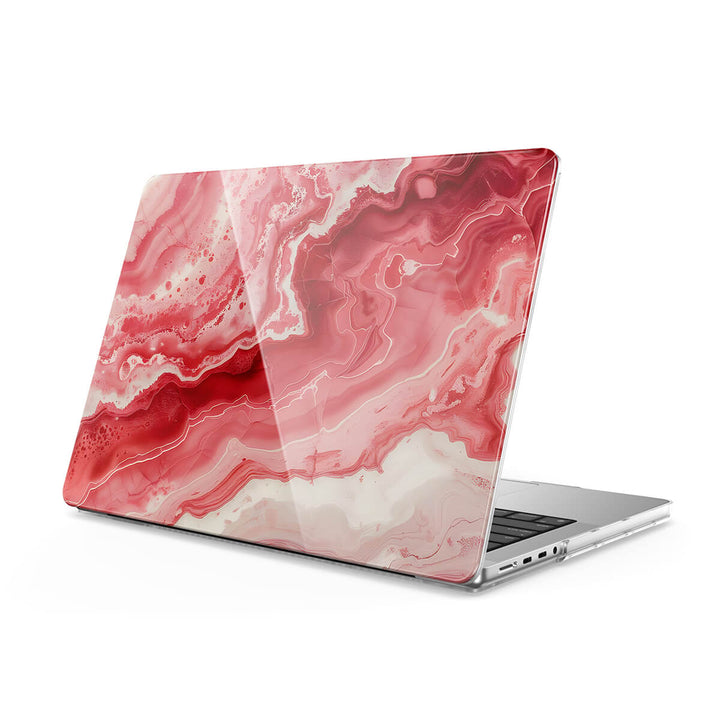 Tieling Red - Macbook Case