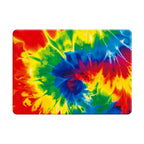 Passion Surges - Macbook Case