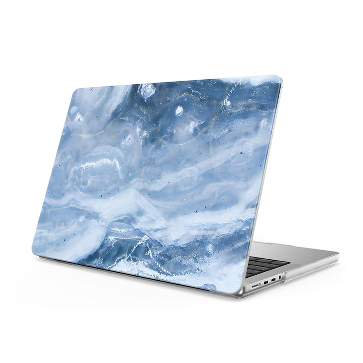 Blue Gray Jade - Macbook Case