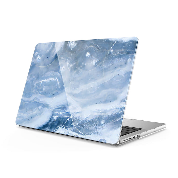 Blue Gray Jade - Macbook Case