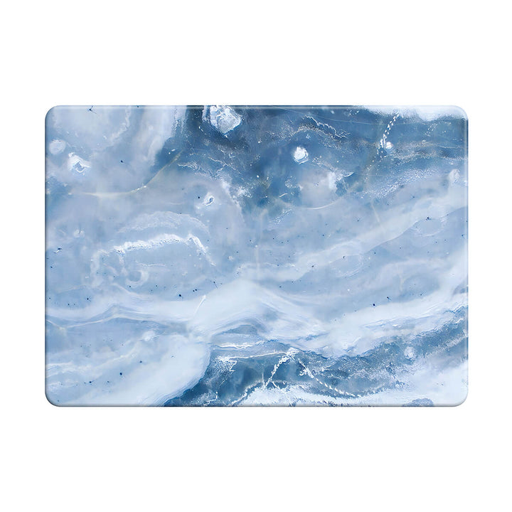 Blue Gray Jade - Macbook Case