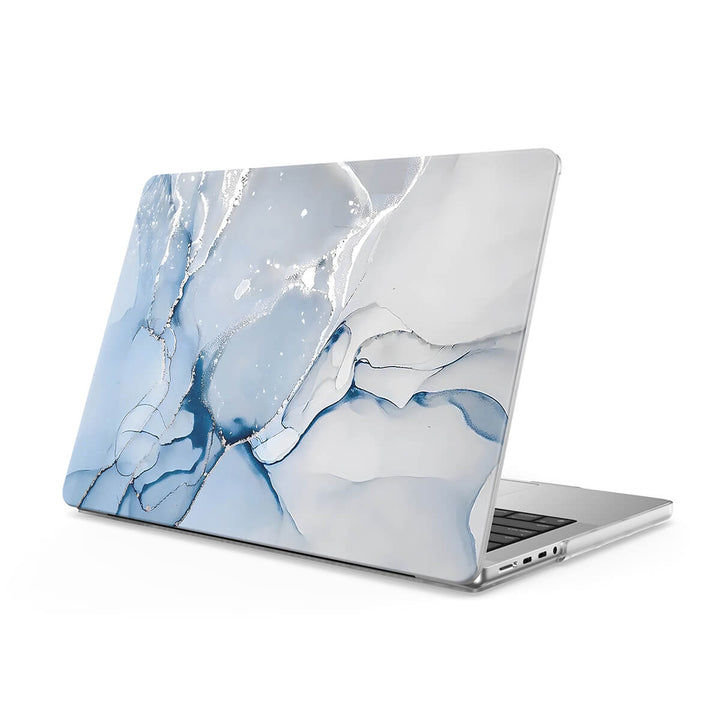 Jazz Silver - Macbook Case