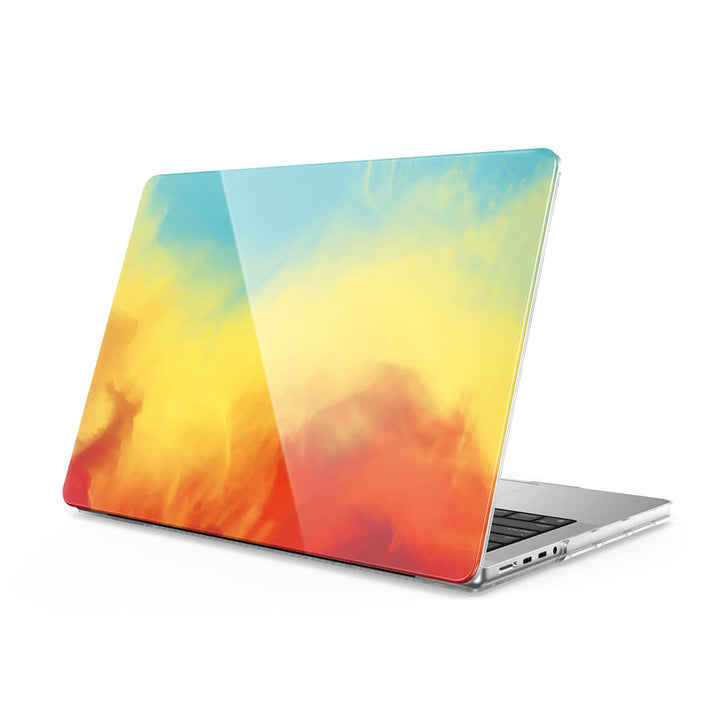 Chasing The Light - Macbook Case