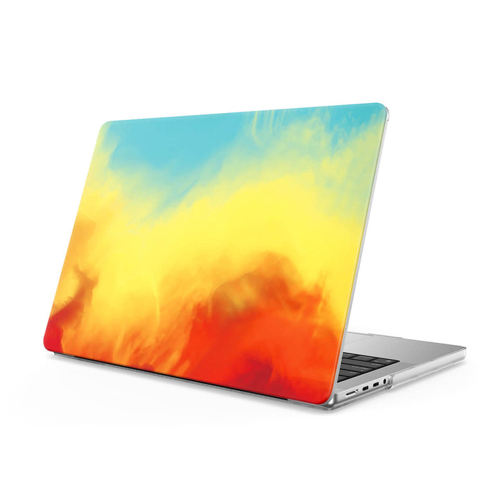 Chasing The Light - Macbook Case