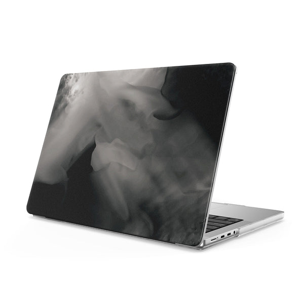 Dissipate - Macbook Case