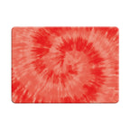 Scarlet Glow - Macbook Case