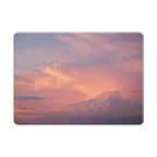 Cloud Gauze - Macbook Case