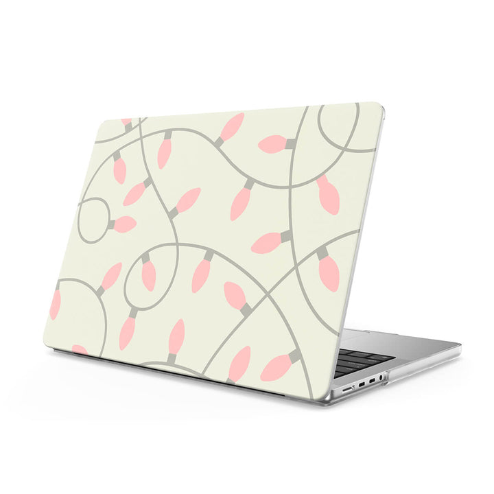 Light Party - Macbook Case